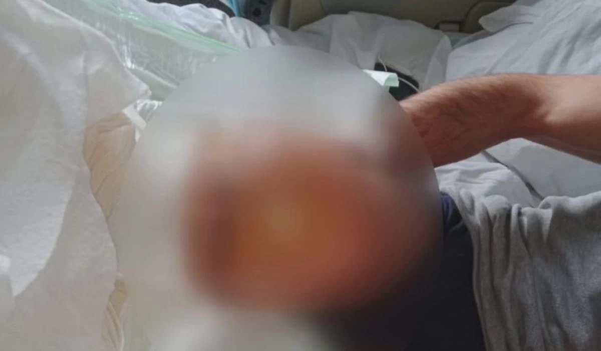 Ankara'da akıl almaz olay! 375 bin lira verdi, hem bacağından hem parasından oldu - Resim : 3